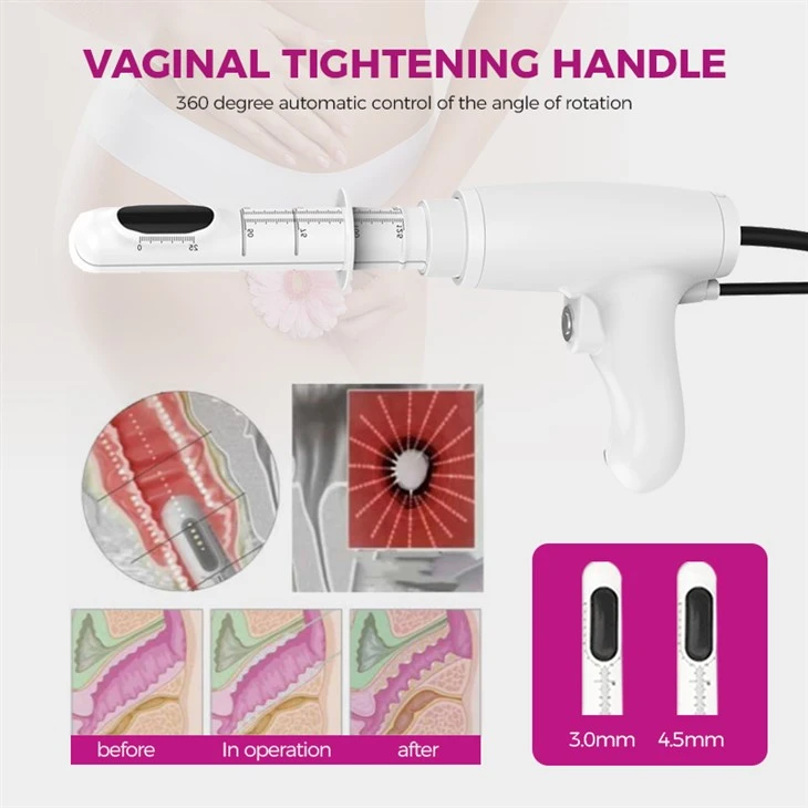 Hifu Machine Price